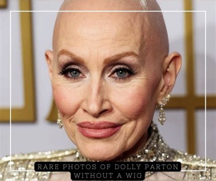 Dolly Parton Without A Wig