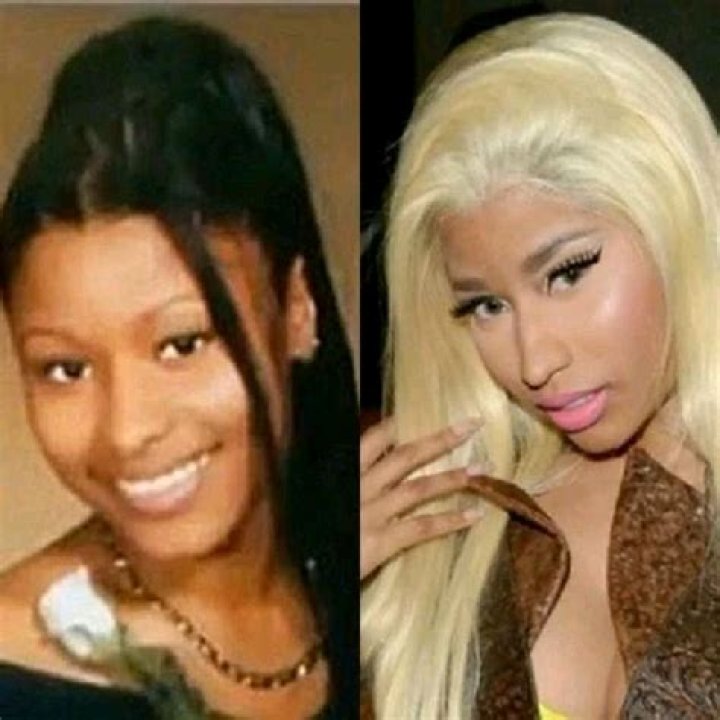 Nicki Minaj Before Skin Bleaching