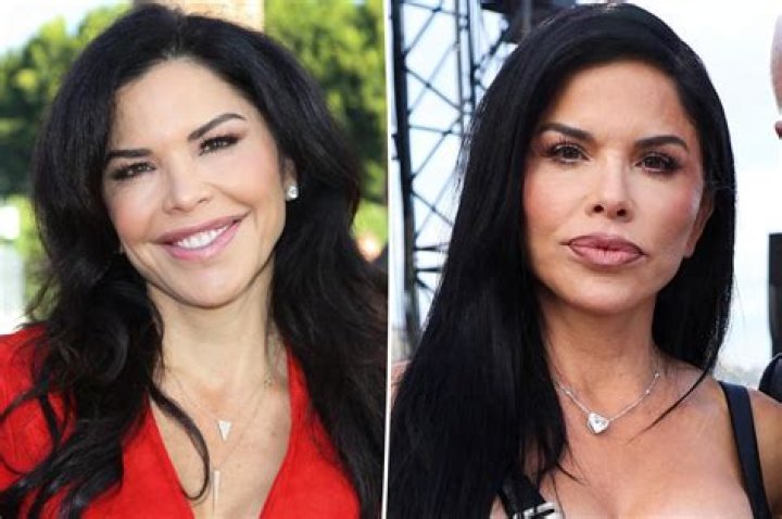 Plastic Surgery Before And After